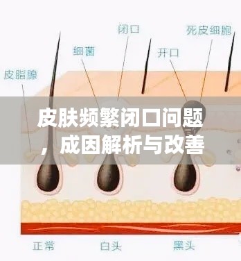 皮肤频繁闭口问题,成因解析与改善方法