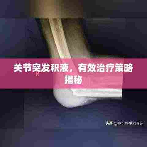关节突发积液，有效治疗策略揭秘