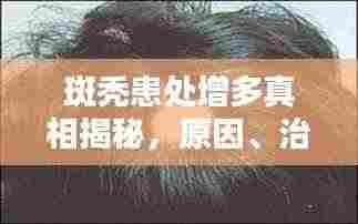 斑秃患处增多真相揭秘，原因、治疗与预防全攻略